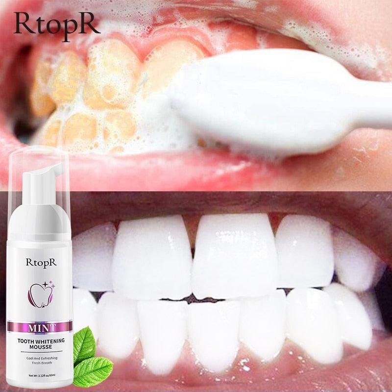 Tooth Whitening Mousse - Amanda beauty