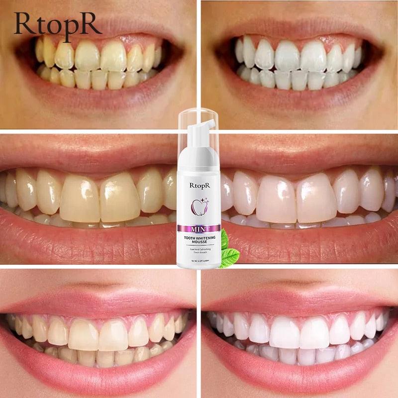 Tooth Whitening Mousse - Amanda beauty