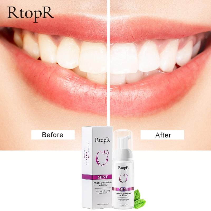 Tooth Whitening Mousse - Amanda beauty