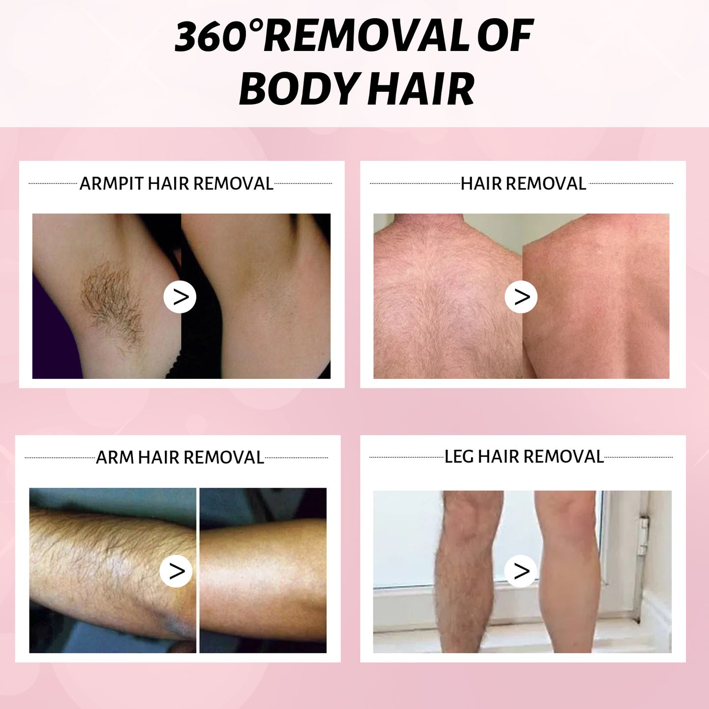 Gentle Hair Removal Spray Cream